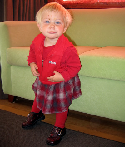 chickenpox7.jpg
